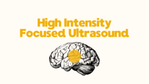 High Intensity Focused Ultrasound for Parkinson's disease